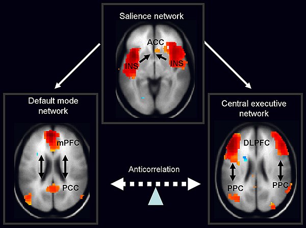 DMN Brain Photo